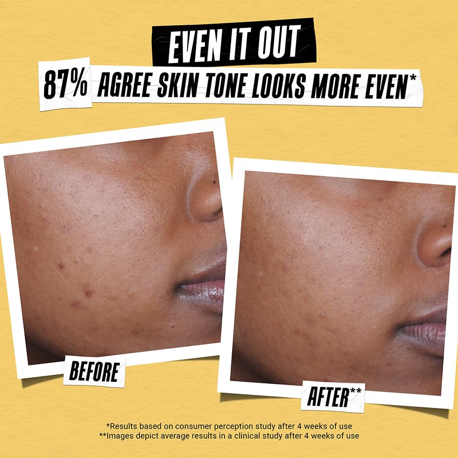 Kiehl’s Better Screen UV Serum SPF 50+ – Invisible Face Sunscreen with Collagen Peptide, UVA/UVB Protection, Anti-Aging & Radiance Boost