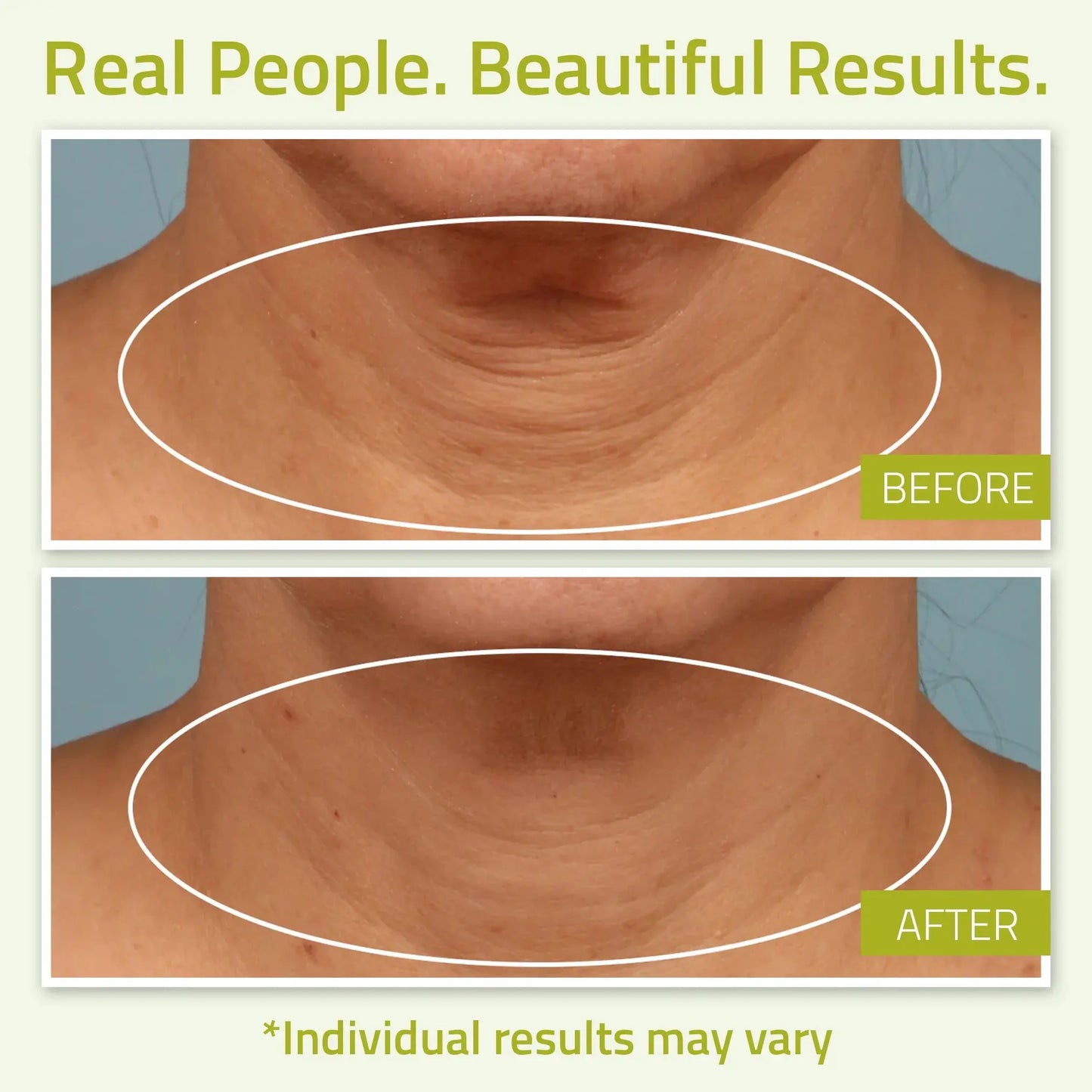 YEOUTH Neck Cream with Vitamin C – Targeting Décolletage, Cleavage, and Chest, 2 Oz