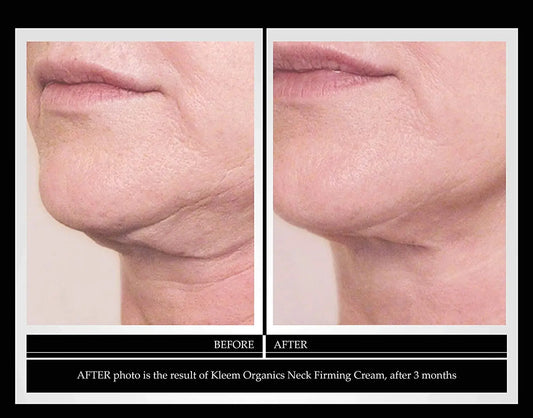 Kleem Organics Neck Firming Cream – Tightening & Lifting Moisturizer for Neck & Décolleté, 1.7 Fl. Oz