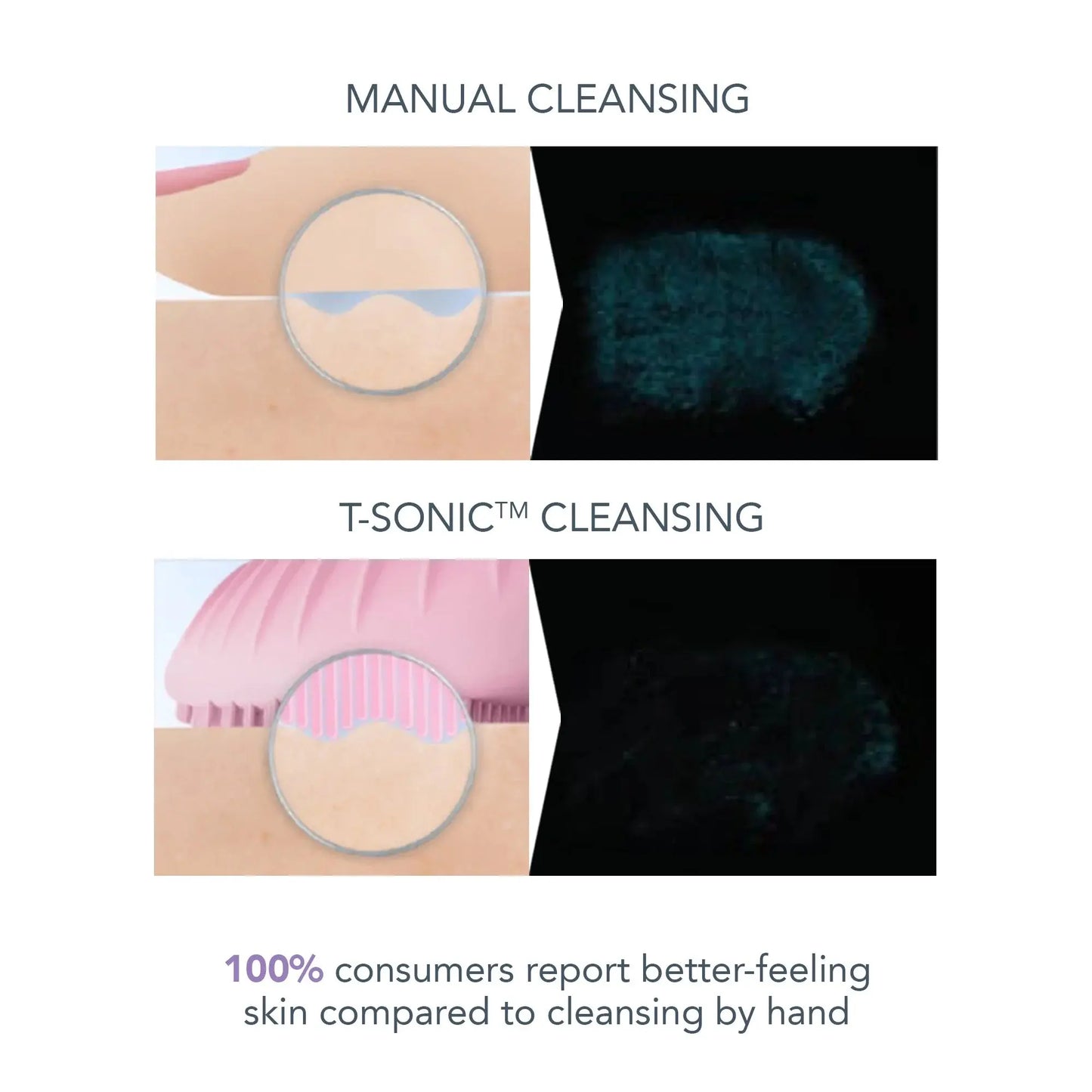 LUNA 3 Smart Sonic Facial Cleanser & Massager for Sensitive Skin – Deep Clean & Anti-Aging Face Brush