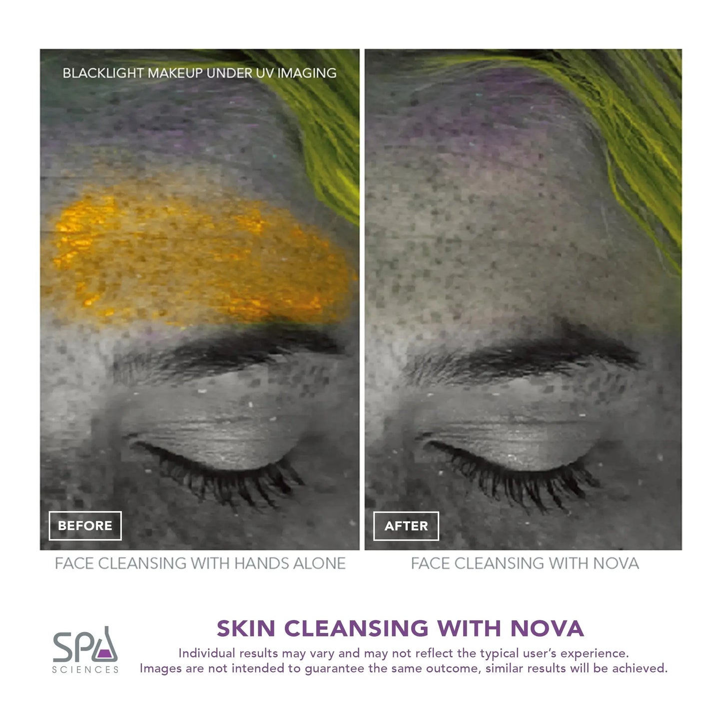 NOVA Sonic Facial Cleansing Brush – Sensitive Skin Exfoliator with Antimicrobial Brush & Serum Infuser, Waterproof & Rechargeable, White