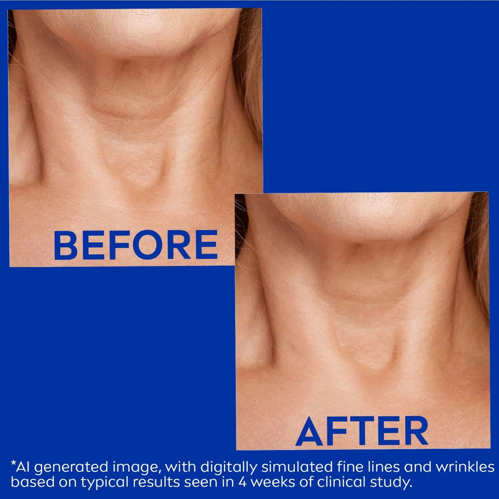 Skin Firming & Anti-Wrinkle Neck & Chest Cream with Q10 & Creatine – 6.7 Oz