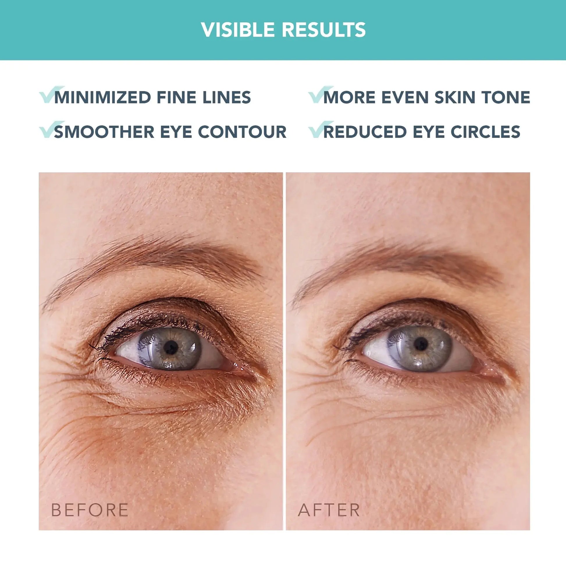 IRIS Hydrating Hydrogel Eye Mask – 60 Pcs for Dark Circles, Puffiness & Wrinkles