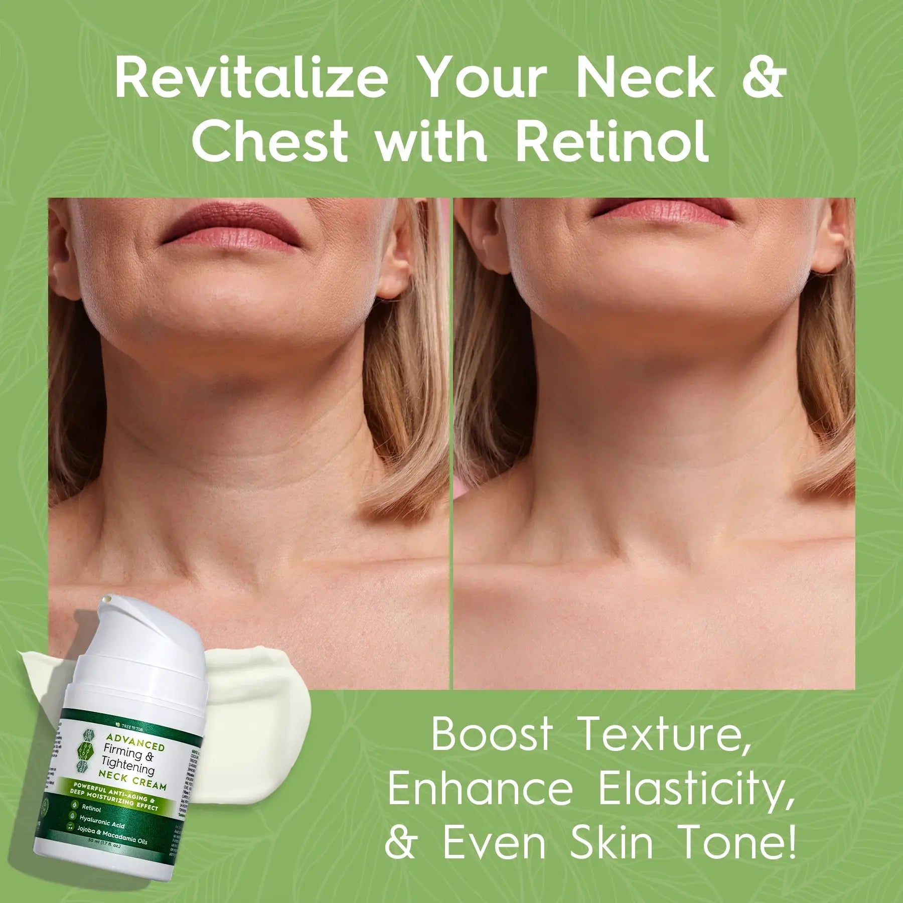 Neck Firming Cream – Advanced Firming Neck & Chest Cream with Hyaluronic Acid & Retinol – Moisturizes, Firms, and Reduces Wrinkles – Unscented, Fast-Absorbing, Anti-Aging – 2 oz